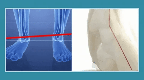 Women’s Breathable Orthopaedic Everyday Trainers