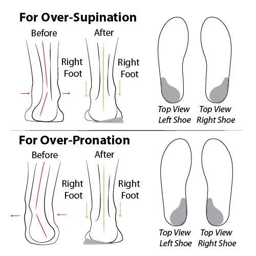 Women’s Breathable Open Toe Arch Support Slippers